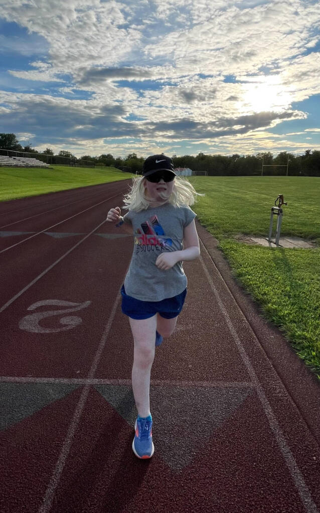 A young woman with albinism running on a track